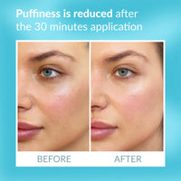 Talika Eye Therapy Patch - Instant Smoothing Eye Patches - Mask For Dark Circles & Tired Eyes - 6 Pairs Reusable & Travel Case