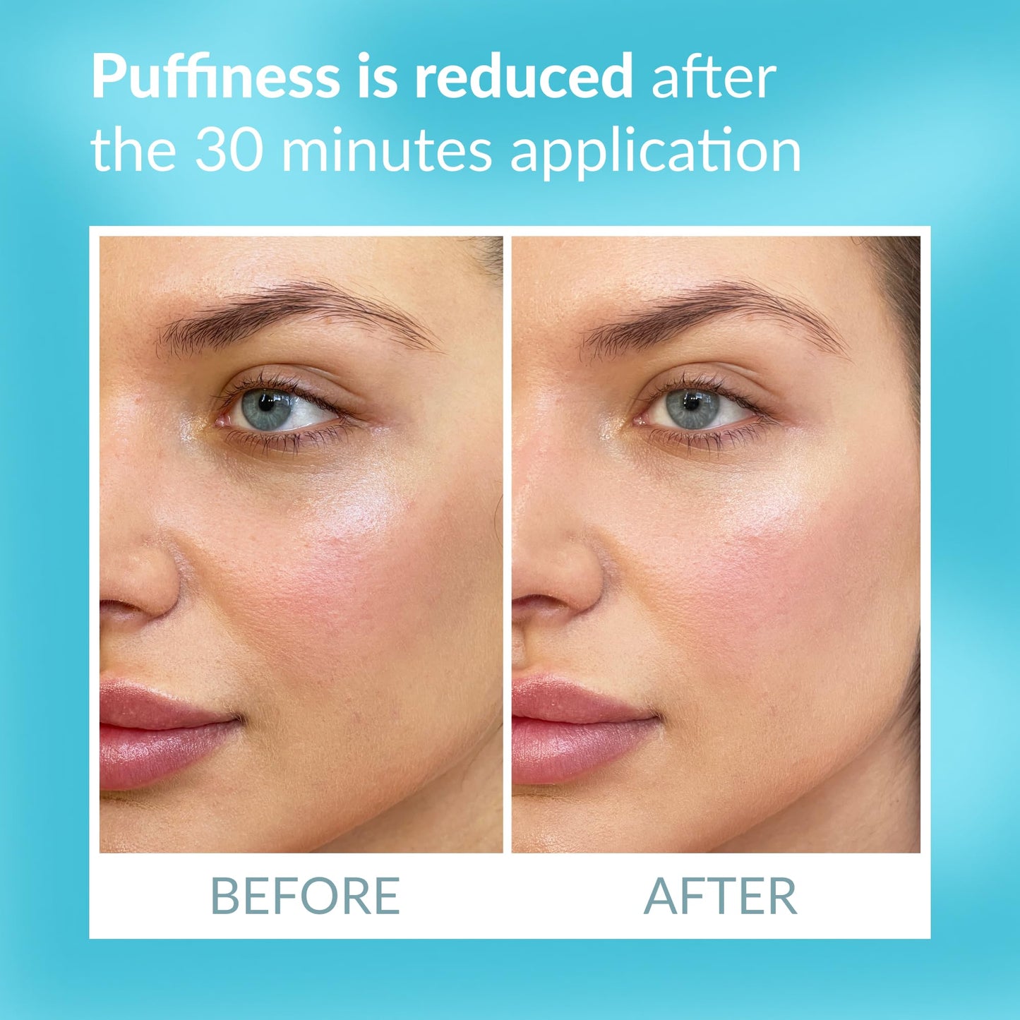 Talika Eye Therapy Patch - Instant Smoothing Under Eye Patches - For Dark Circles Puffiness & Tired Eyes - Reusable Under Eye Patch Skincare Eye Treatment