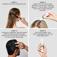 Philip Kingsley | Flaky/Itchy Scalp Masks | Anti-Dandruff Mask For Flaky, Itchy, Dry, Oily Scalps | Cleansing Scalp Care | Mask that Hydrates, Soothes and Calms | 2 x 2ml