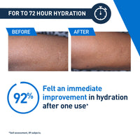 CeraVe, Intensive Moisturising Lotion, With Hyaluronic Acid, 3 Essential Ceramides & Hydro-Urea Technology, For Dry to Very Dry Skin 473ML