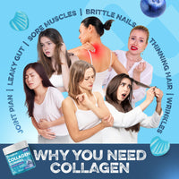 supplmnt. Supplmnt. Marine Collagen Gummies, Hydrolysed Collagen Peptides with Biotin, Hyaluronic Acid & Vitamin C, Supplements for Women & Men, for Skin, Hair & Nails, Blueberry