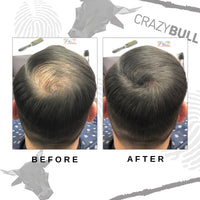 CrazyBull Hair Building Fibre - Long-Lasting, Easy Apply Hair Fibre Concealer for Thinning Hair & Bald Spots - Vegan & Cruelty-Free Hair Thickening Fibre for Men & Women - Crazy Bull, 22g, Blonde