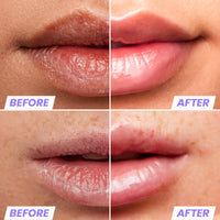 Wonderskin Lip Oil Rehab Serum - Hydrating and Moisturizing Clear Serum for Dry Lips - Natural, Vegan and Non-sticky (Clear)