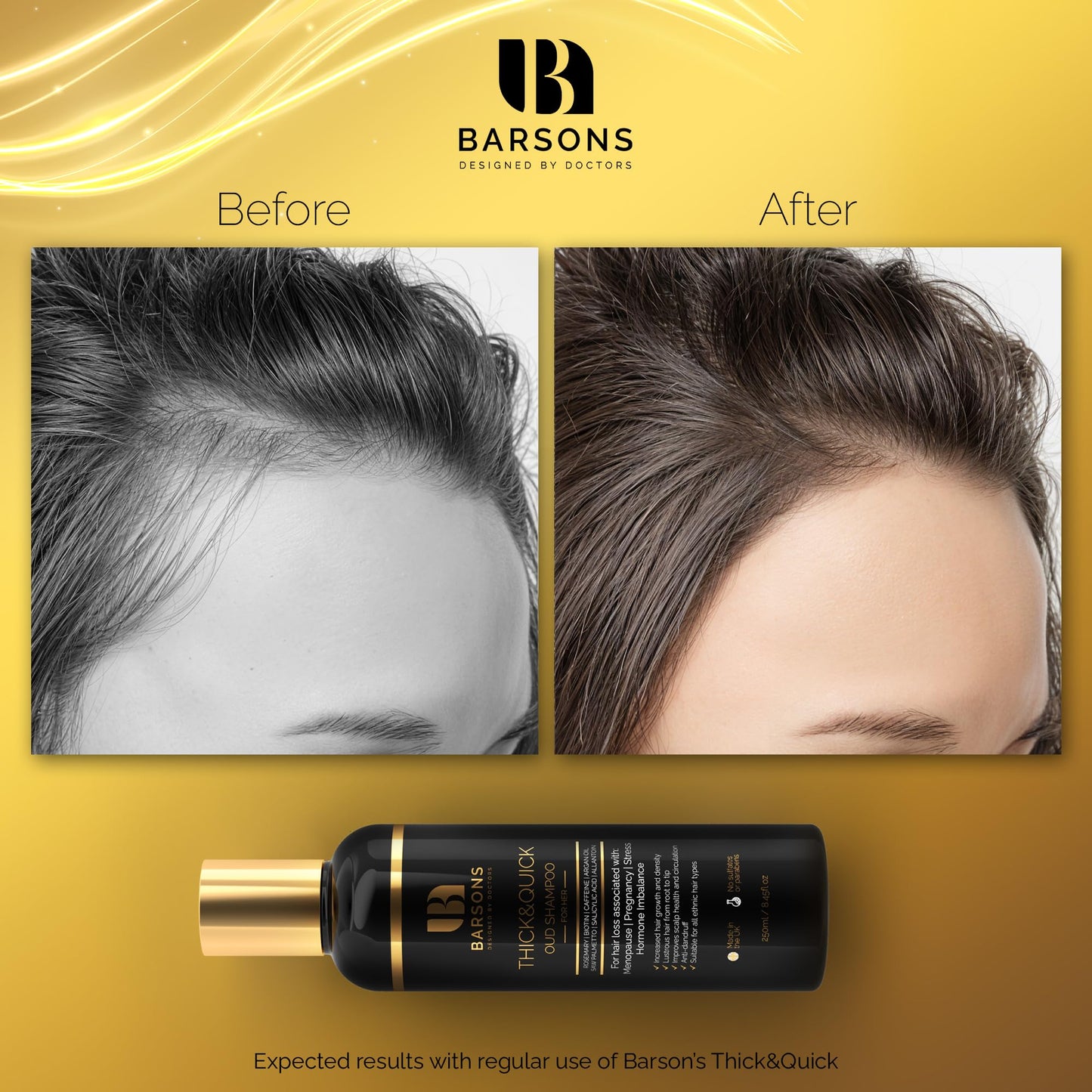 BARSONS Oud Shampoo for HER. Luxury Haircare Formula, designed by Doctors & Hair Stylists | Rosemary Oil, Argan Oil, Biotin, Caffeine, Saw Palmetto | Nourishing Shampoo for Thicker & Fuller Hair