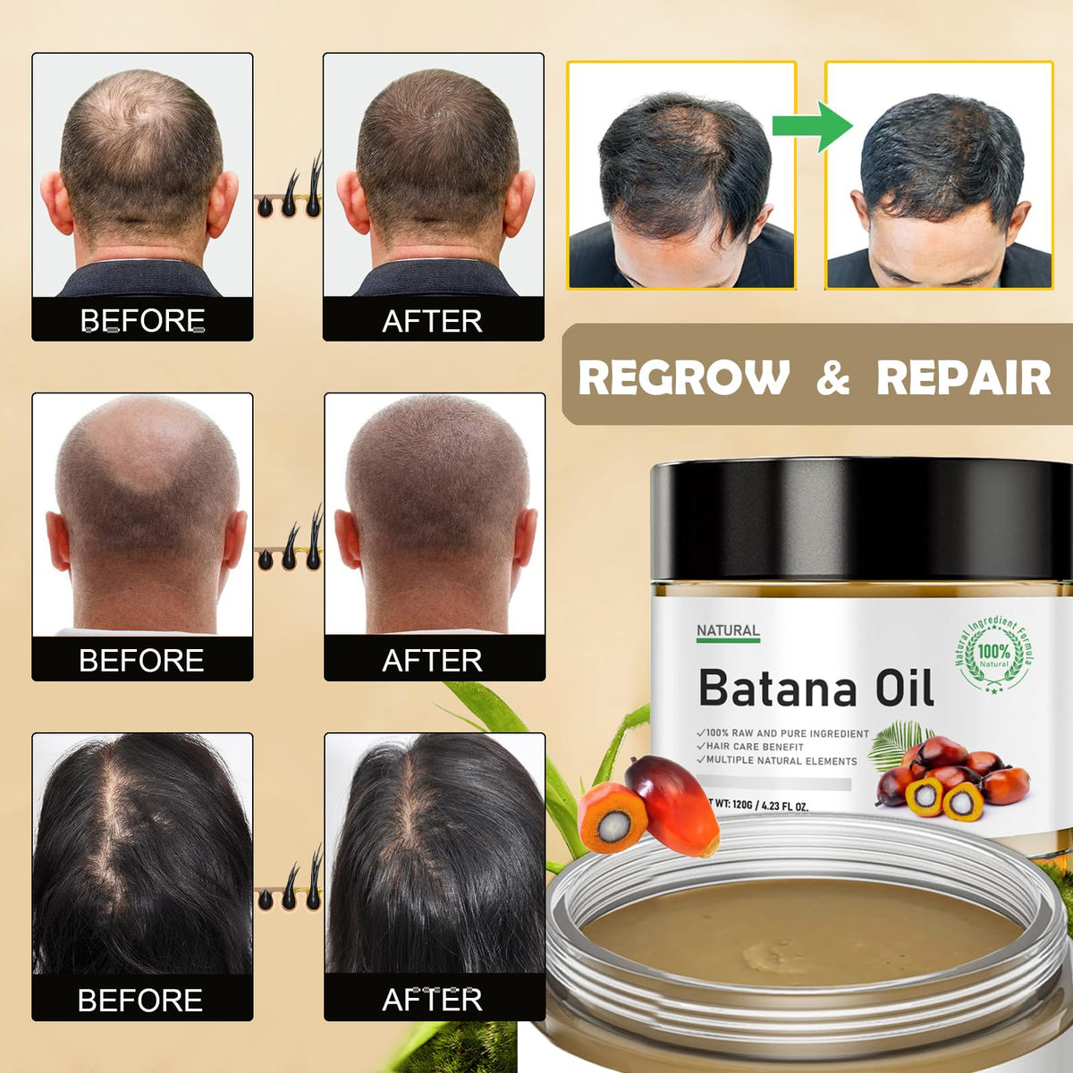 MINSHZEE Batana Hair Growth Oil, 100% Pure Natural from Honduras, Organic Hair Mask, Reduces Hair Loss, Moisturising the scalp, and repairing damaged, dry hair, Repairs Damaged Hair & Scalp (120g)