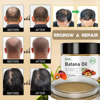 MINSHZEE Batana Hair Growth Oil, 100% Pure Natural from Honduras, Organic Hair Mask, Reduces Hair Loss, Moisturising the scalp, and repairing damaged, dry hair, Repairs Damaged Hair & Scalp (120g)