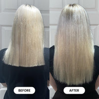 HAIR BURST Chewable Vegan Hair Vitamins - Hair Vitamins for Growth and Hair Loss – Hair Supplements for Both Men and Woman - Biotin Hair Growth Vitamins - 1 Month Supply - 60 Gummies