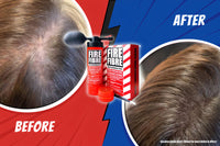 Fire Fibre Hair Fibres for Thinning Hair Undetectable & Natural - 28g Bottle - Completely Conceals Hair Loss Instantly - Hair Thickener & Topper for Fine Hair for Men & Women (Black)