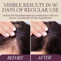 MEGI Wellness Hair Growth Shampoo for Thinning Hair 200ml – DHT Blocker for Women & Men – Caffeine, Biotin & AnaGain™ – Minoxidil Alternative for Hair Growth – Sulphate-Free, Colour Safe, Vegan