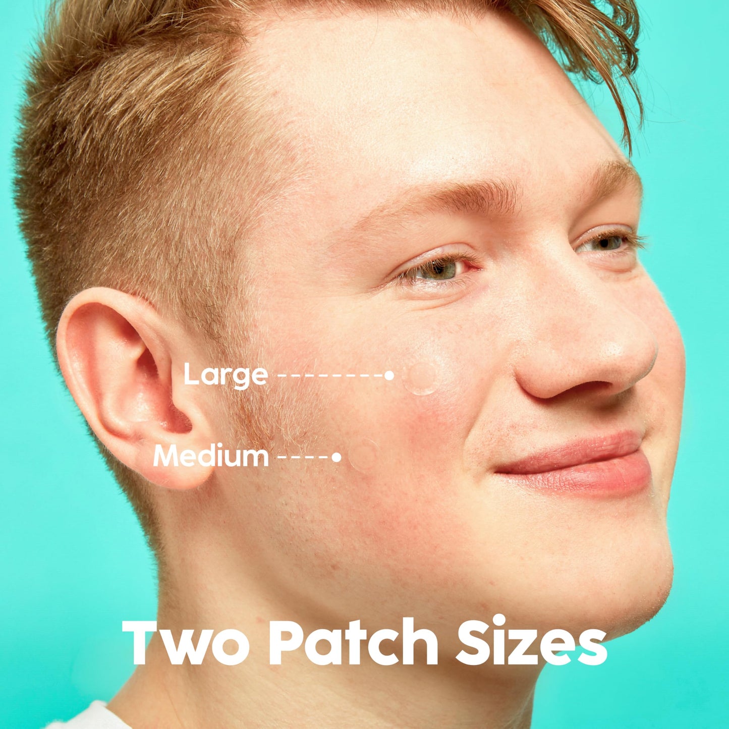 Patch Perfect Spot Patches (102 Count) - Korean Hydrocolloid Pimple Patches, Absorbing Dots for Spot Treatment, Invisible Acne Patches, Vegan & Cruelty-Free Spot Stickers (2 Sizes)