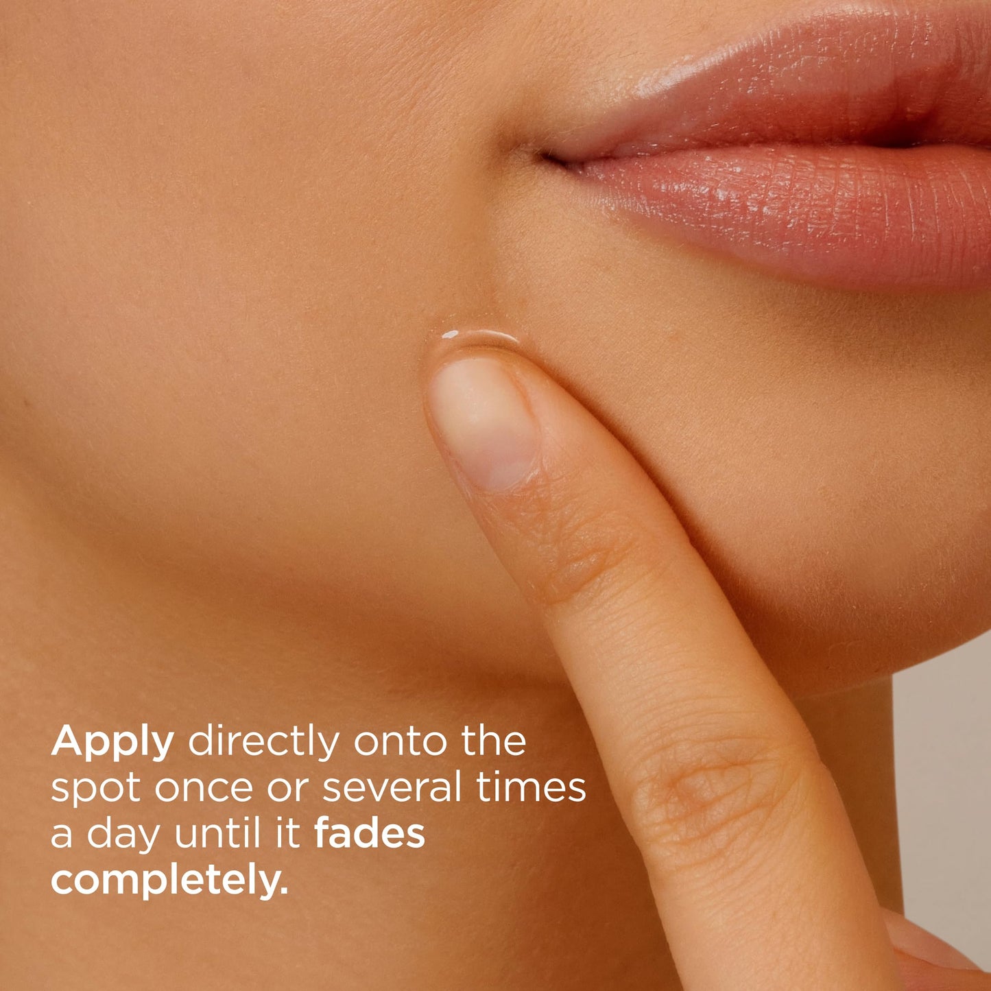 ISDIN Acniben On The Spot, Facial Pimples Corrector Drying Gel, Reduces Redness and Pimples Volume, with Salicylic Acid and Niacinamide, Duplo Pack 2 units