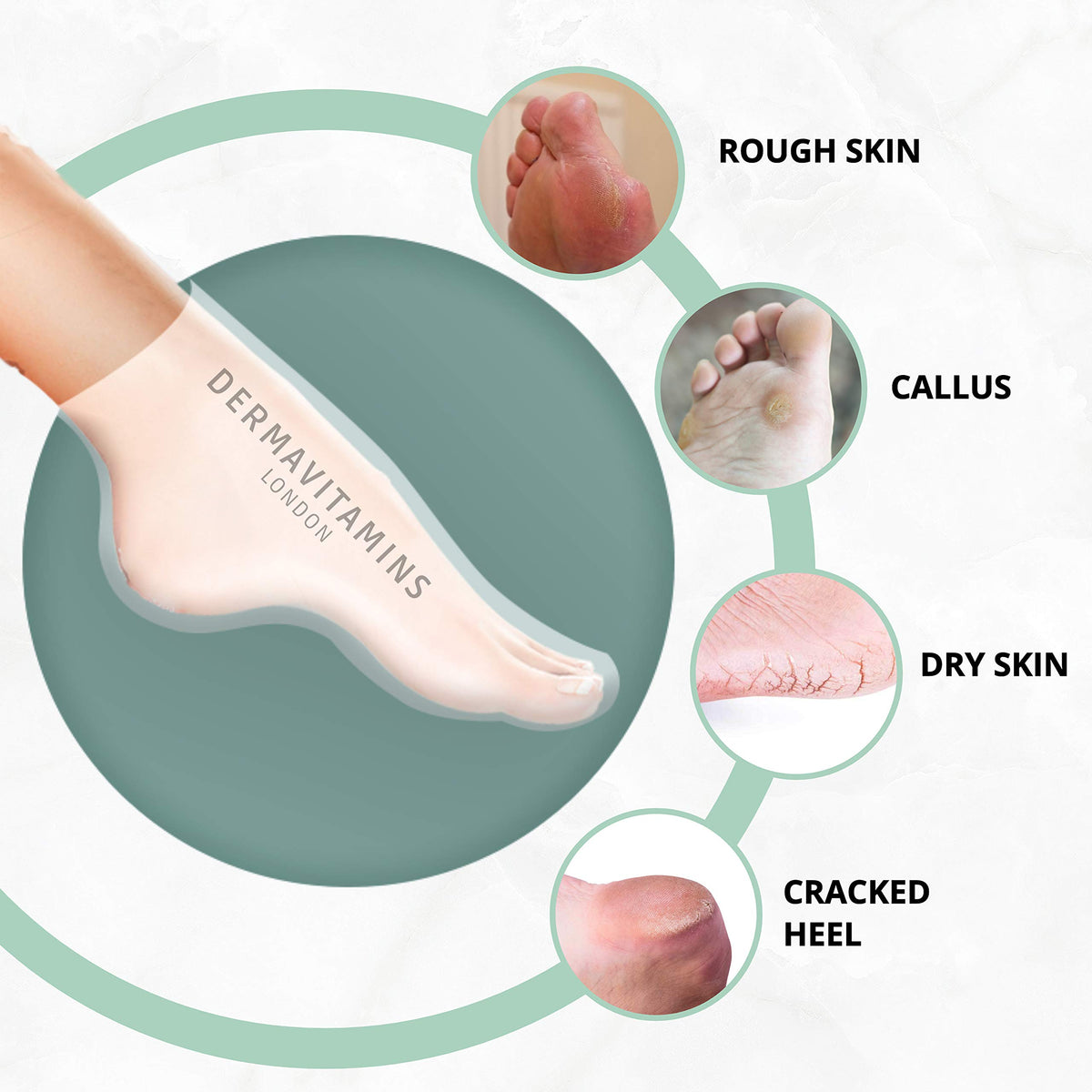 Dermavitamins Advanced Foot Mask Bag - Repairs Dry Feet (Peeling)