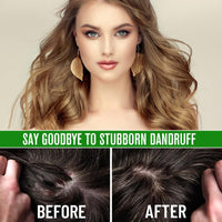 Generic 100% Pure & Natural Batana Hair Growth Oil-Eliminates Split Ends-Prevent Hair Loss-Increases Shine for Men & Women-For Thicker & Stronger Hair-Repairs Damaged Hair & Skin For Men & Women(60ml)