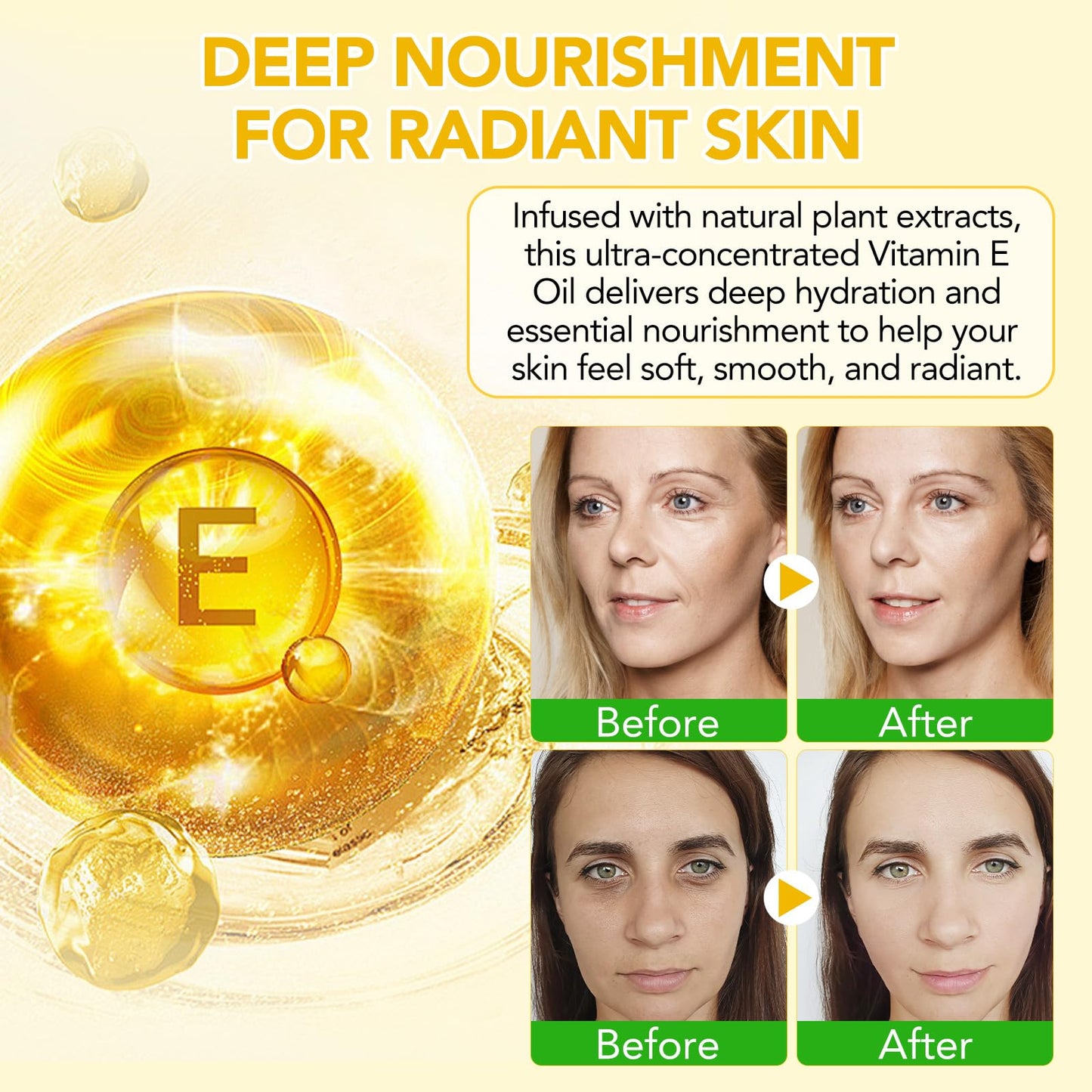 LEISGOTO Vitamin E Oil, 100% Pure Natural Plant Extracts Vitamin E Oil for Skin, Face, Reduces Scars & Stretch Marks, Smooths Fine Lines & Wrinkles, Firms & Boosts Skin Elasticity - 60ml Body Oil (Pack of 1)