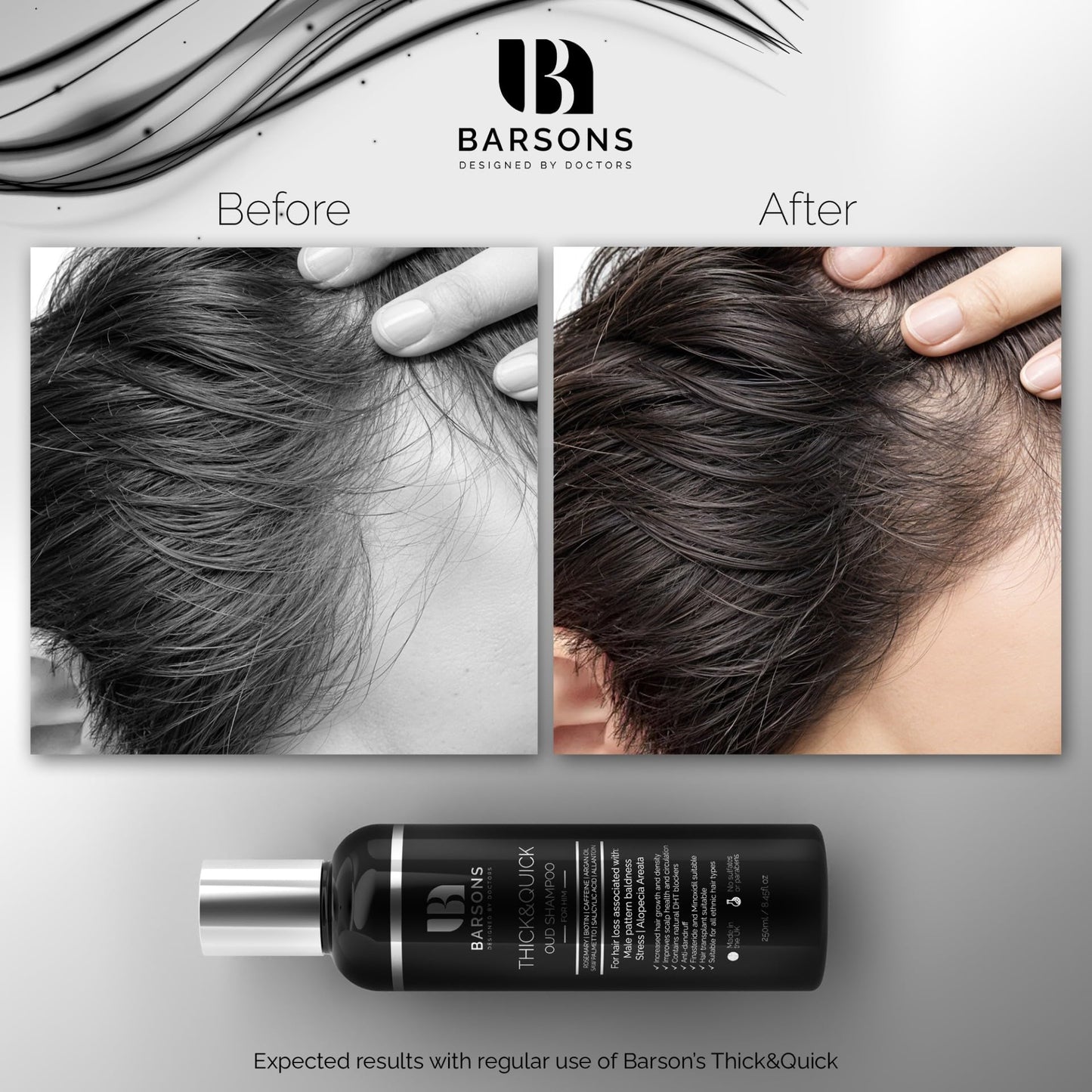 BARSONS Oud Shampoo for HIM. Haircare Formula by Doctors & Hair Stylists | Hair Thickening Treatment for men with thinning hair | Hair-transplant Compatible