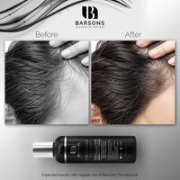 BARSONS Oud Shampoo for HIM. Haircare Formula by Doctors & Hair Stylists | Hair Thickening Treatment for men with thinning hair | Hair-transplant Compatible