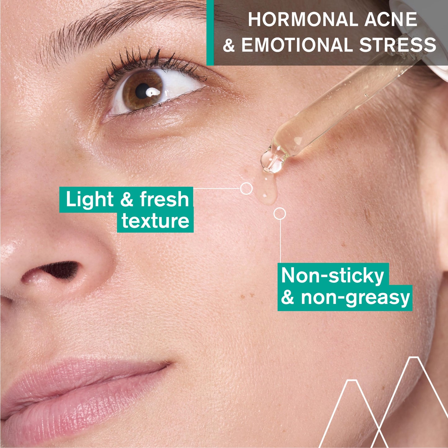 Uriage Hyseac Anti-Acne Serum - 30ml - Clear Skin Solution for Oily and Acne-Prone Skin