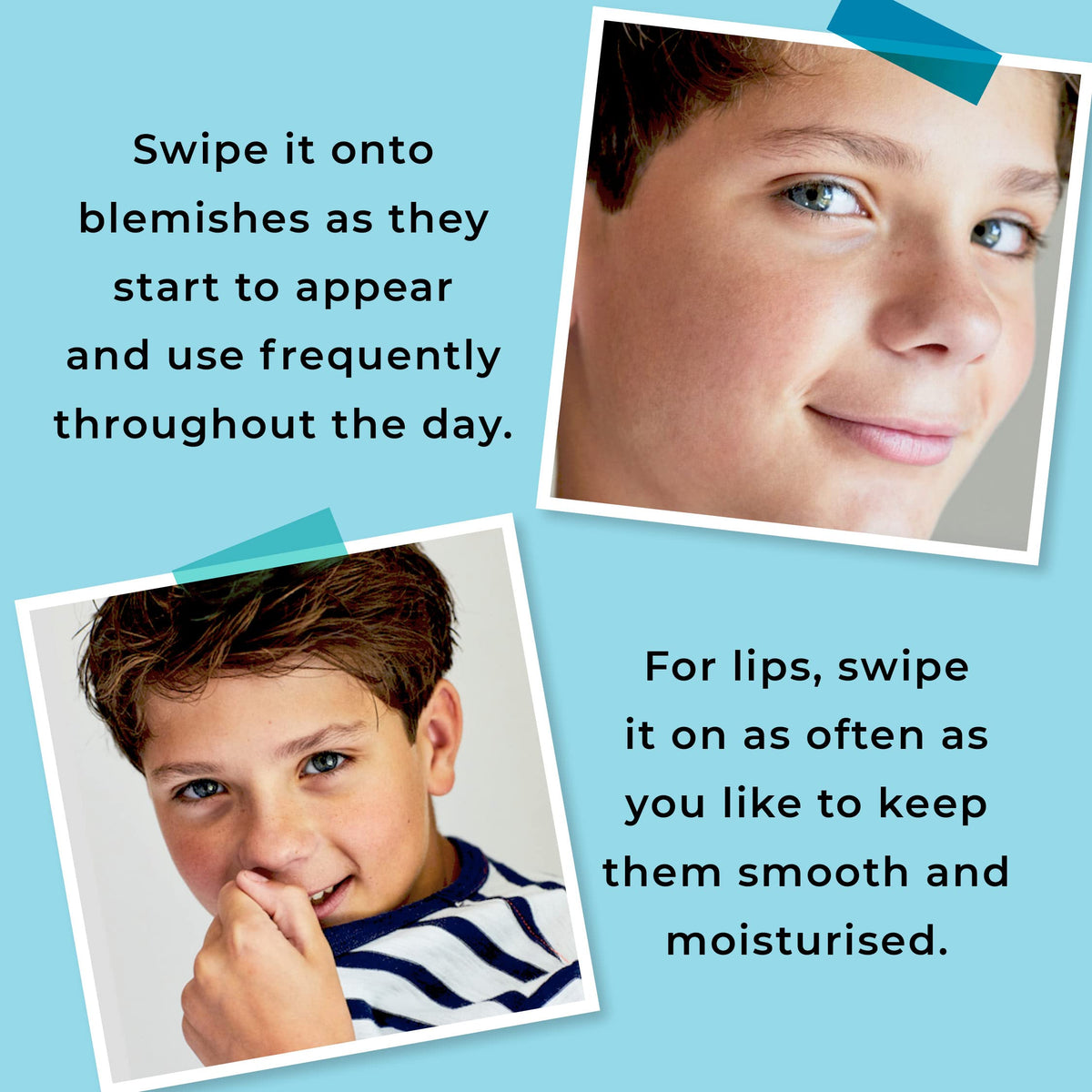 Spots & Stripes - Teenage Spot Treatment Boys, 100% Natural Skincare, Multi-Purpose Spot Zapper, Lip Balm and Skin Rescue for Tweens in One Genius Stick, with Niaouli, Coconut and Myrrh (15g)