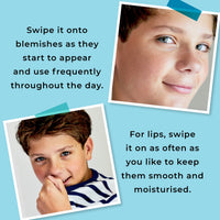 Spots & Stripes - Teenage Spot Treatment Boys, 100% Natural Skincare, Multi-Purpose Spot Zapper, Lip Balm and Skin Rescue for Tweens in One Genius Stick, with Niaouli, Coconut and Myrrh (15g)