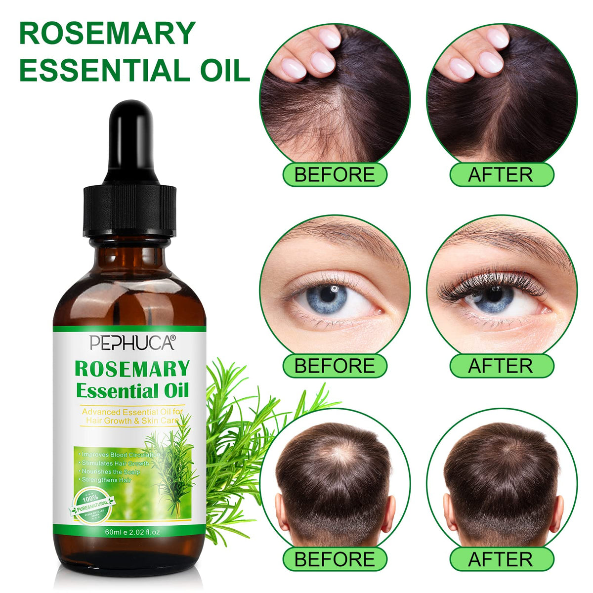 FVVSIEDK Rosemary Oil for Hair Regrowth(2.02 Fl Oz),Mulitpurpose 100% Pure Rosemary Essential Oil for Hair Loss,Hair Skin Nail Nourishment,Stimulates Hair Growth,Rid of Itchy and Dry Scalp for Unisex