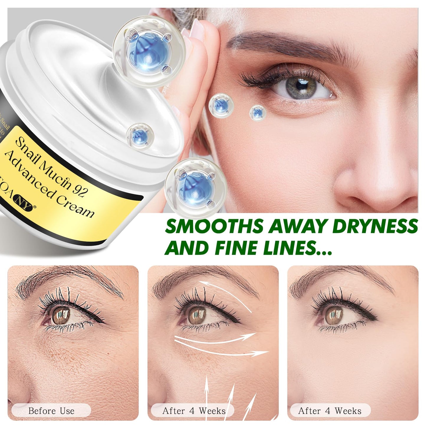 APCKFLEE Advanced Snail Mucin 92 All in one Cream, Snail Mucin Repair Cream,Snail Secretion Moisturizer, Facial Moisturiser, Long Lasting, Deep & Intense Hydration