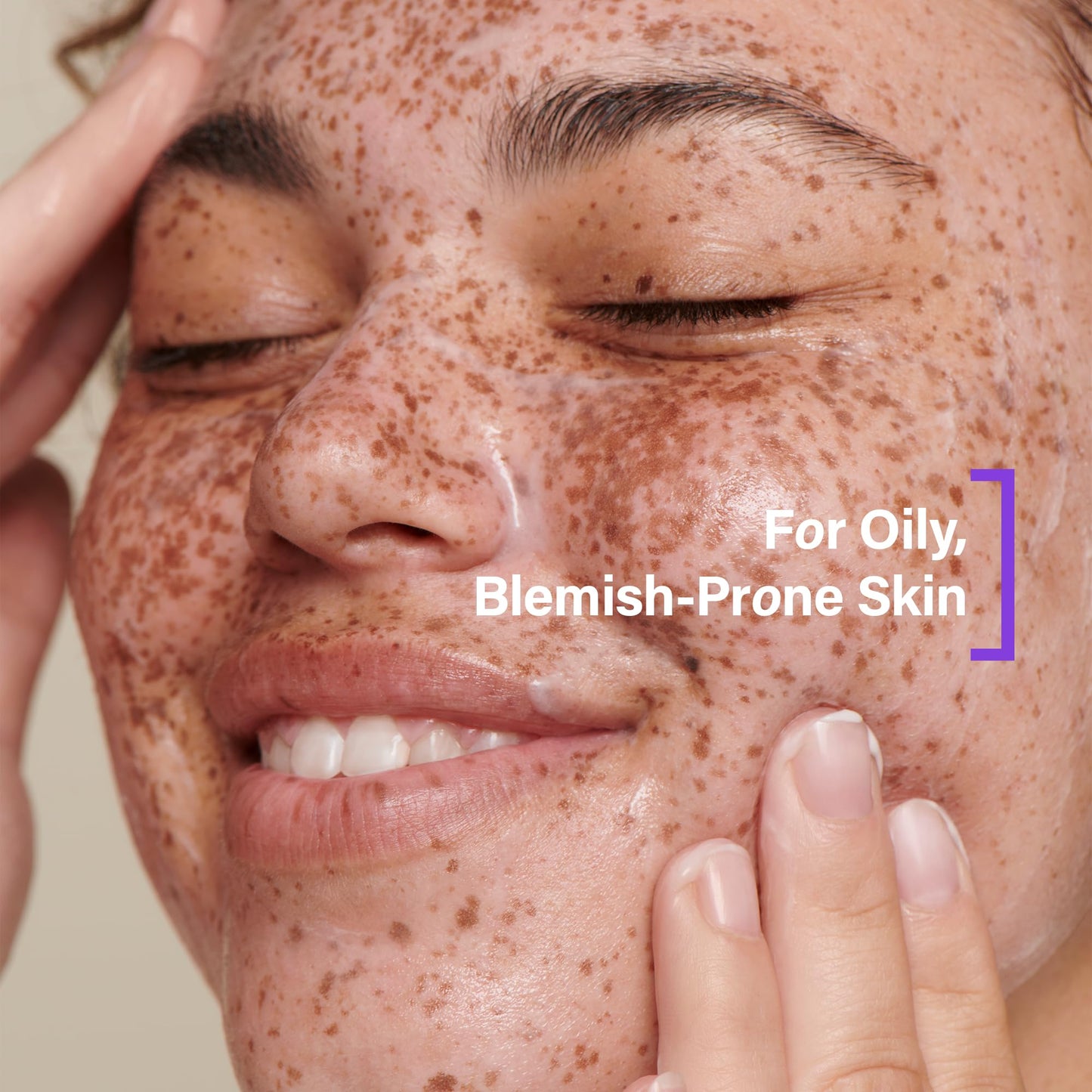 Coats Daily Blemish Defence Duo for Oily Skin – Purifying Hydrating Clay Cleanser 150 ml + Triple Moisture Water Cream 75 ml – Helps Prevent Breakouts + Protect the Skin Barrier