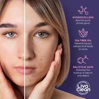 LivaClean 240 Count Colorful Star-Shaped Pimple Patches for Face – Hydrocolloid Acne Patches – Cute Pimple Patches, Pimple Stickers, Zit Dots, Hydrocolloid Bandages, Acne Stickers