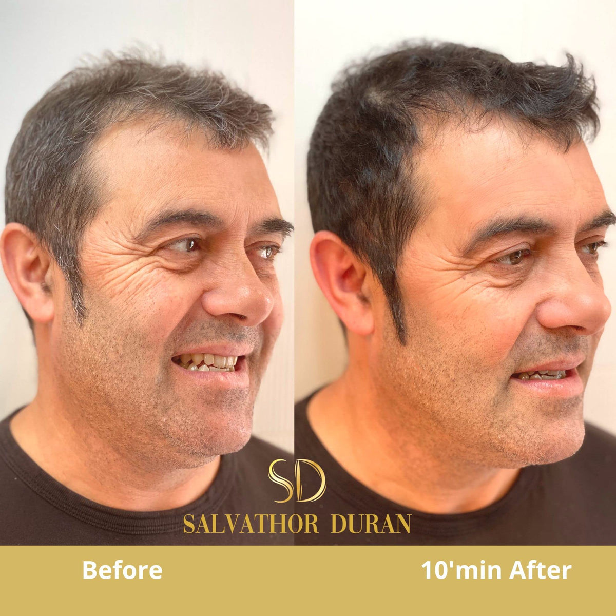 Mens Hair Dye Salvathor Duran - 20 Applications - Beard Dye - Natural Hair Dye - Hair Dye For Men - Mens Beard Dye - Beard Dye Black - Gradual or Complete Changement in the First Application - 250 ml.