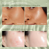 Mikloven 2PCS Aloe Vera After Sun Gel Stick – Natural Soothing Care for Face & Body, Hydrating & Non-Irritating Moisturiser, Travel Size Lotion for Sensitive Skin,15g