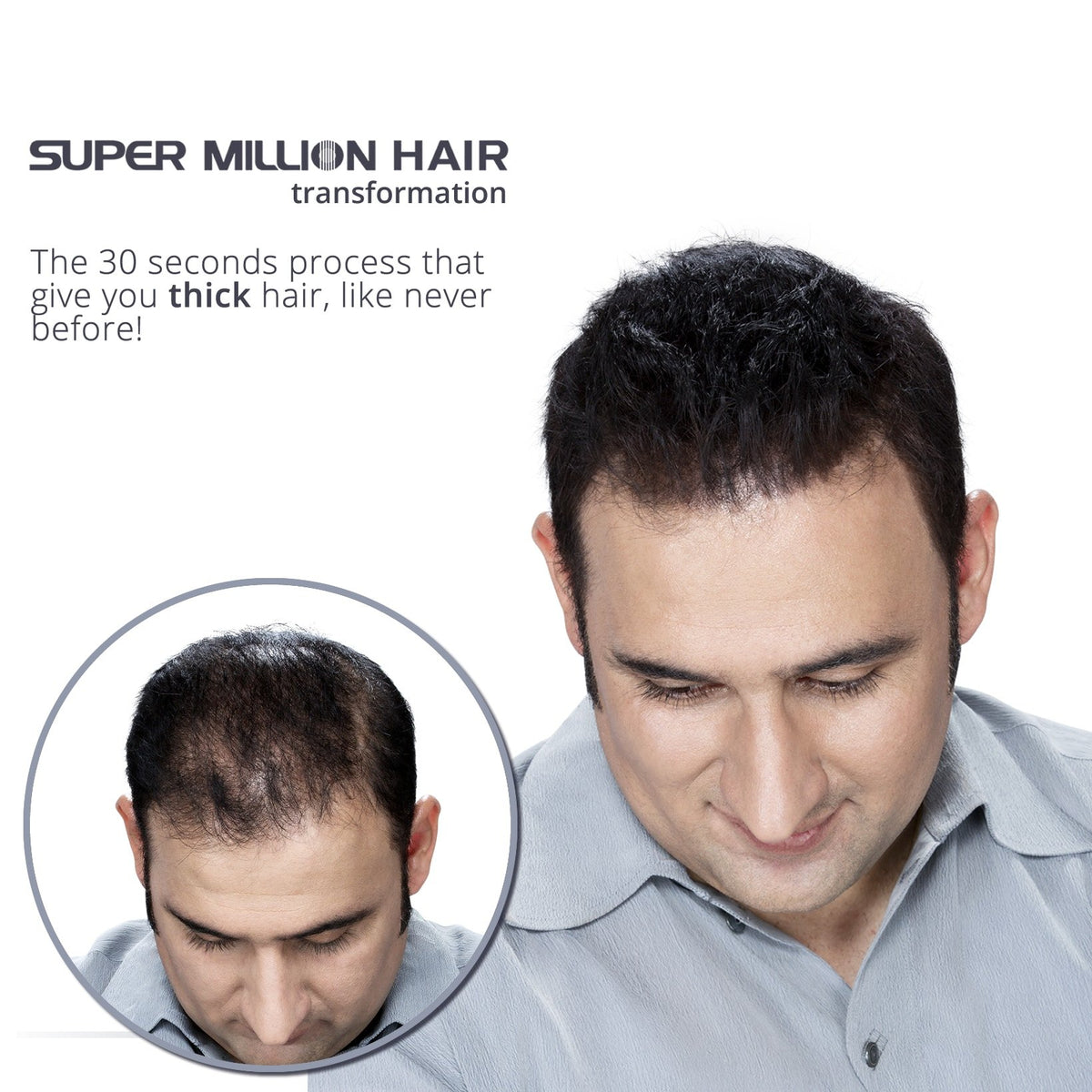 Super Million Hair Fibres - 10g - 15g - 20g - 25g - 40g. (15g, No.2 Dark Brown)