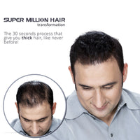 Super Million Hair Fibres - 10g - 15g - 20g - 25g - 40g. (15g, No.2 Dark Brown)
