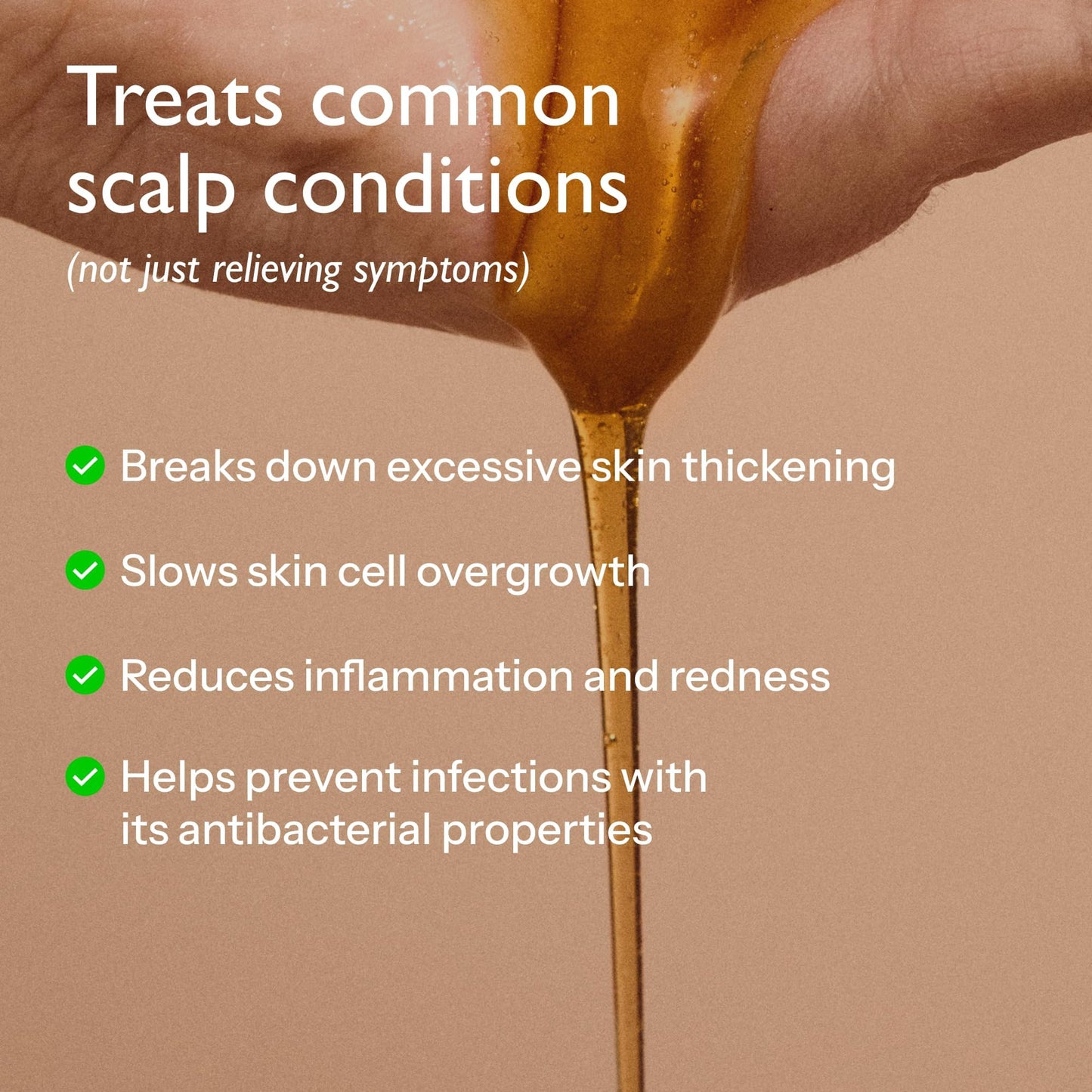 Polytar Scalp Shampoo, For Scalp Conditions, Reduces Itching, Inflammation and Scales, Shampoo Treats Psoriasis, Seborrhoeic Dermatitis, Eczema and Dandruff, Contains Coal Tar Solution, 1 x 150ml