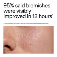 The INKEY List Succinic Acid Treatment 15ml