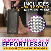 NYK1 RUSTPROOF Foot File Callus Remover for Feet with Catcher | XL Size