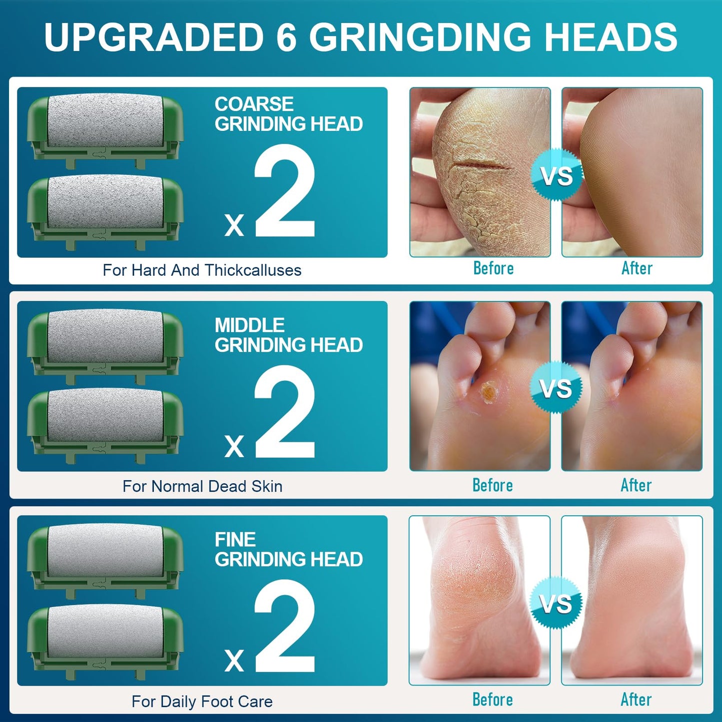 Hoxida Electric Foot File for Hard Skin, with 6 Replacement Rollers, IPX7 Waterproof Rechargeable Callus Remover for Feet Pedicure Set for Dead Skin (Green)