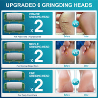 Hoxida Electric Foot File for Hard Skin, with 6 Replacement Rollers, IPX7 Waterproof Rechargeable Callus Remover for Feet Pedicure Set for Dead Skin (Green)