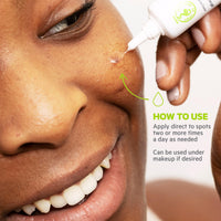 SVR SEBIACLEAR Cicapeel Spot-Targeting Active Gel for Acne-Prone, Oily, Combination Skin, SOS Anti-Marks Invisible Treatment, 15ml