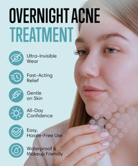 Absorbzit - The Overnight Hydrocolloid Pimple Patches, Thick & Durable Spot Patches, Vegan & Cruelty-Free Acne Treatment - 36 Nighttime Patches