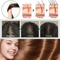 RoongDuuDll Batana Oil Hair Mask for Hair Growth, 100% Natural Growth Oil, Batana Organic Prevent Hair Loss with Rosemary and Biotin, Helps with Frizz, Split Ends, Texture & Shine for Men & Women - 60g