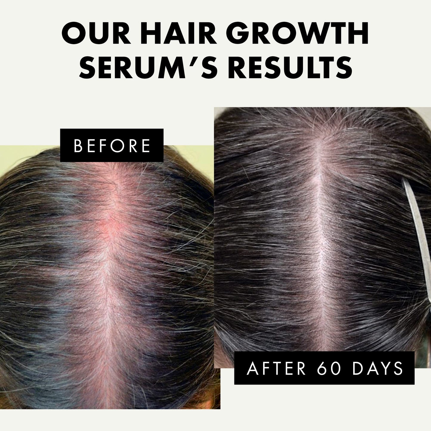 Hair Growth Serum - Hair Serum for Dry Damaged Hair, Hair Serum for Frizzy Hair - Biotin Oil Hair, Anti Frizz Hair Serum for Men and Women, Sulphate Free, Vegan