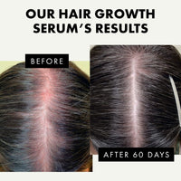 Hair Growth Serum - Hair Serum for Dry Damaged Hair, Hair Serum for Frizzy Hair - Biotin Oil Hair, Anti Frizz Hair Serum for Men and Women, Sulphate Free, Vegan