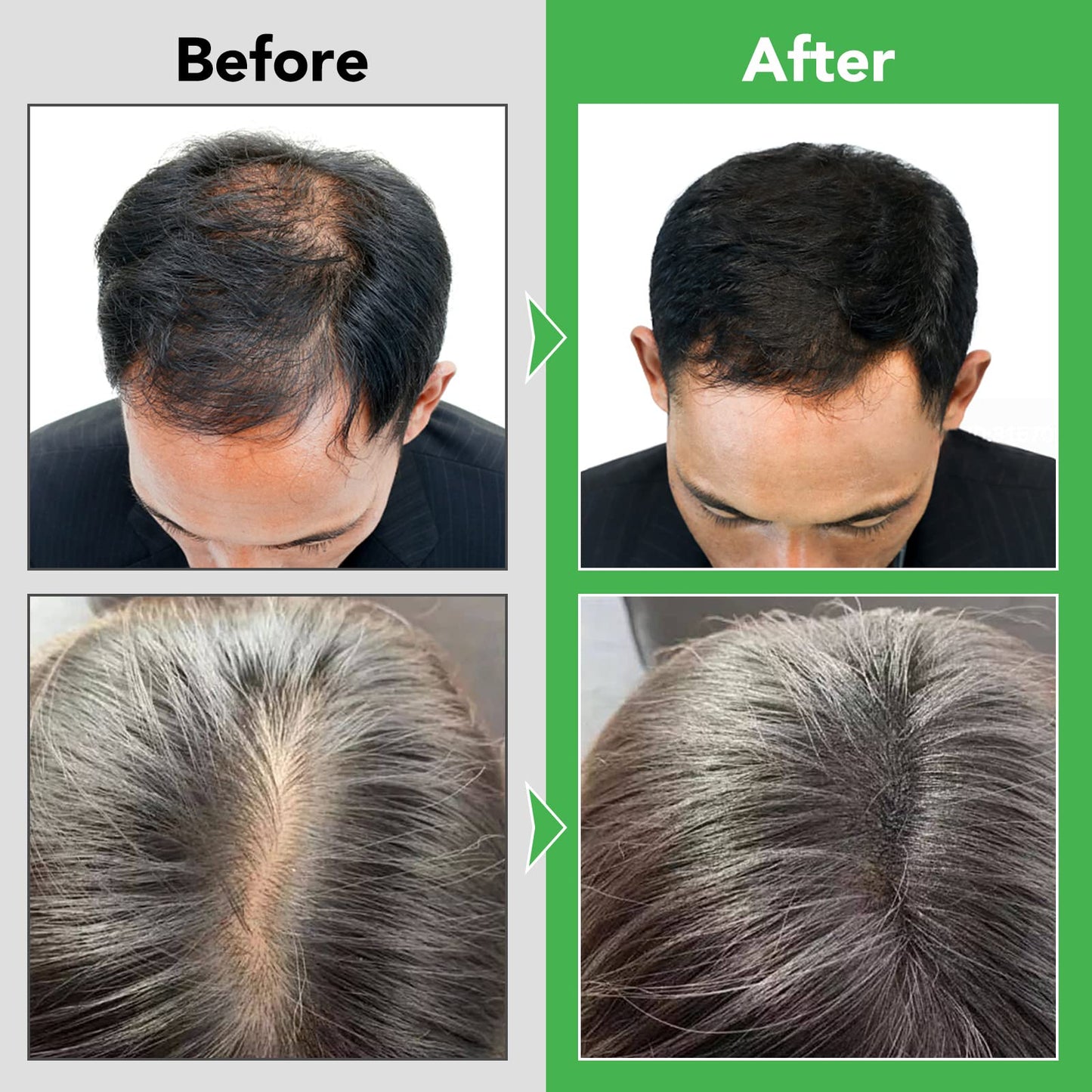 JYW Natural Rosemary Strengthening Shampoo with Mint, Hair Nourishing Formula with Biotin, 300ml