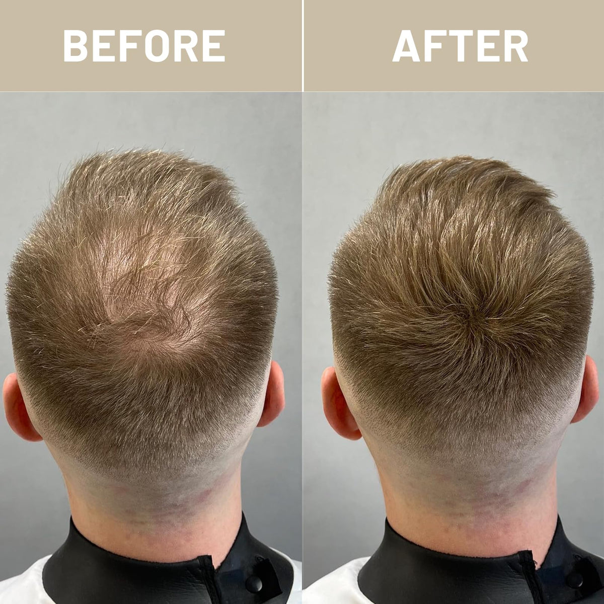 VOLLUCK Hair Fibres, Hair Thickening Products for Women Men, Long-lasting Hair Thick Fiber for Hair Loss 28 g (Auburn)