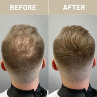 VOLLUCK Hair Fibres, Hair Thickening Products for Women Men, Long-lasting Hair Thick Fiber for Hair Loss 28 g (Auburn)