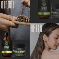 Castor Oil Shampoo with Biotin, Ricin Oil and Argan Oil For Growth & Restores Volume Hair, For Thinning and Damaged Hair Paraben Free Sulfate Free