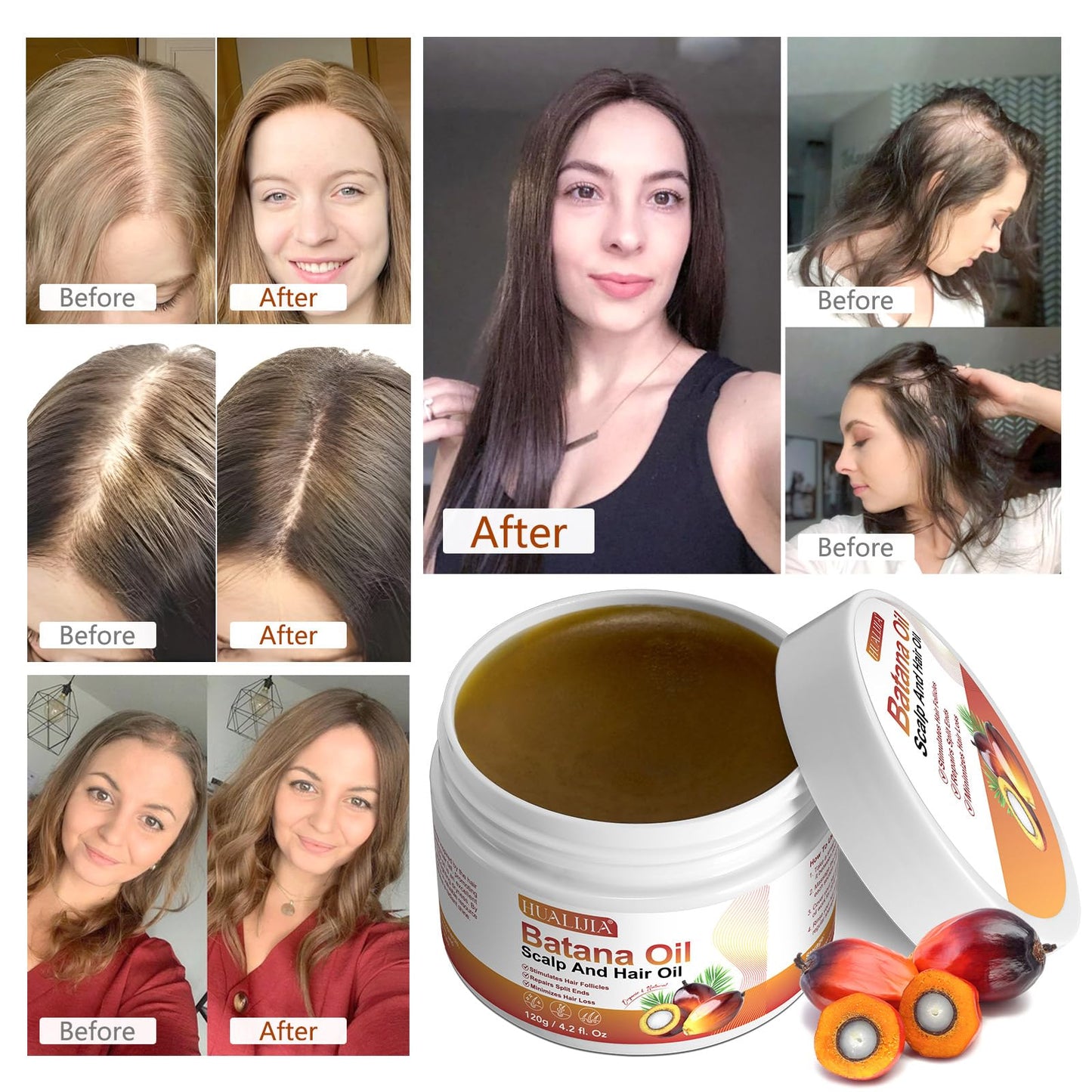 NIFEISHI Raw Batana Oil for Hair Growth and Repair, Pure & Organic Batana Oil from Honduras Stimulate Hair Growth, Prevent Hair Loss and Enhances Hair Thicknes, 120g