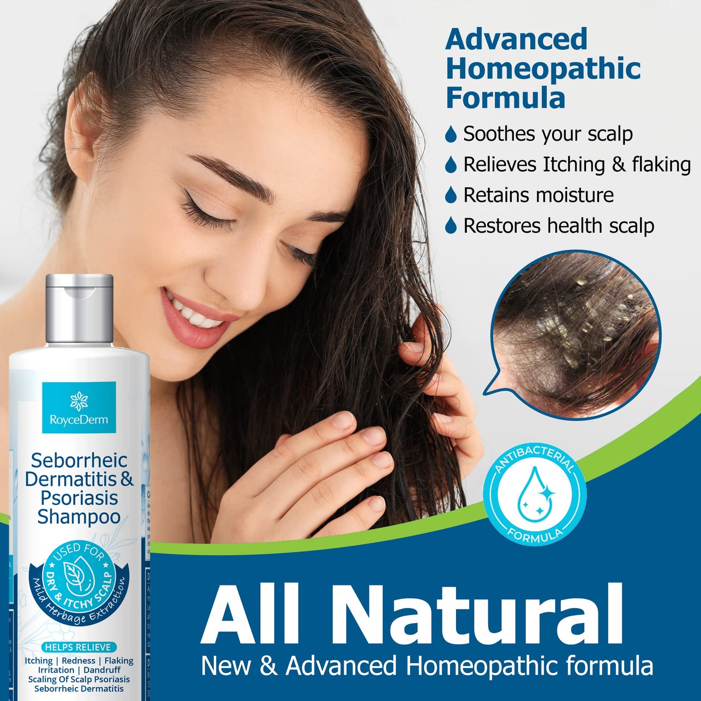 Roycederm Seborrheic Dermatitis Shampoo – Psoriasis, Dandruff & Folliculitis Care – Scalp Treatment for Itch, Flakes & Irritation