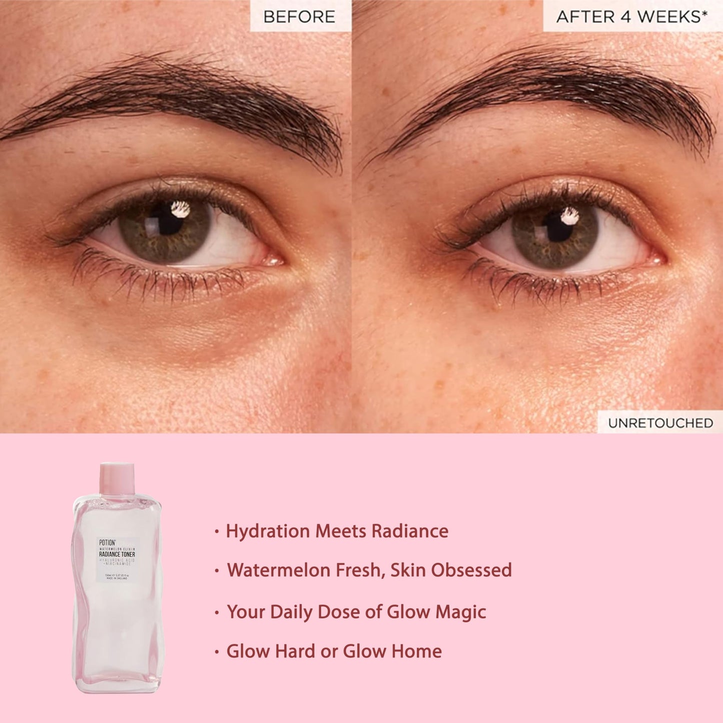 Katsy Style Watermelon Elixir Radiance Toner | Hydrating & Brightening Face Toner with Hyaluronic Acid & Niacinamide | Refreshing & Plumping Skincare 150ml