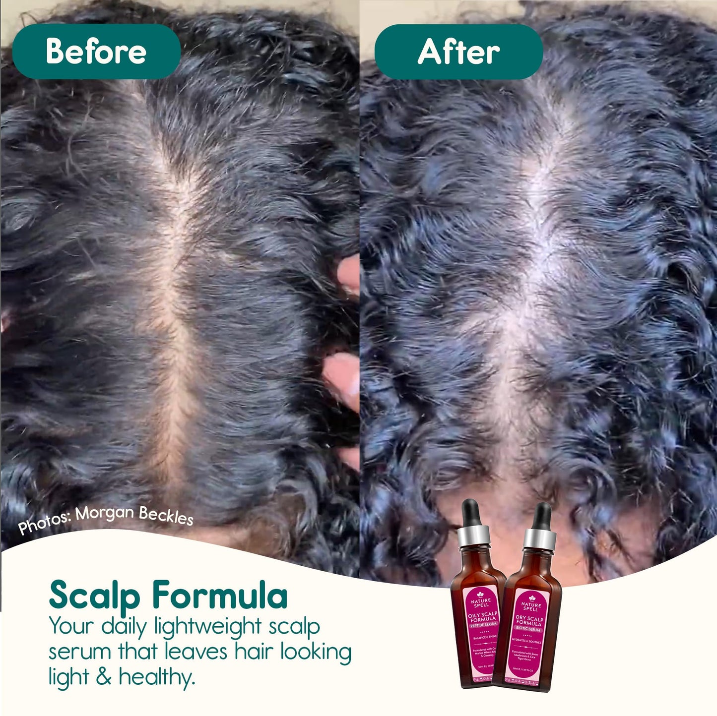 Nature Spell Dry Scalp Serum, Hydrating & Soothing Formula, Vegan, 50ml