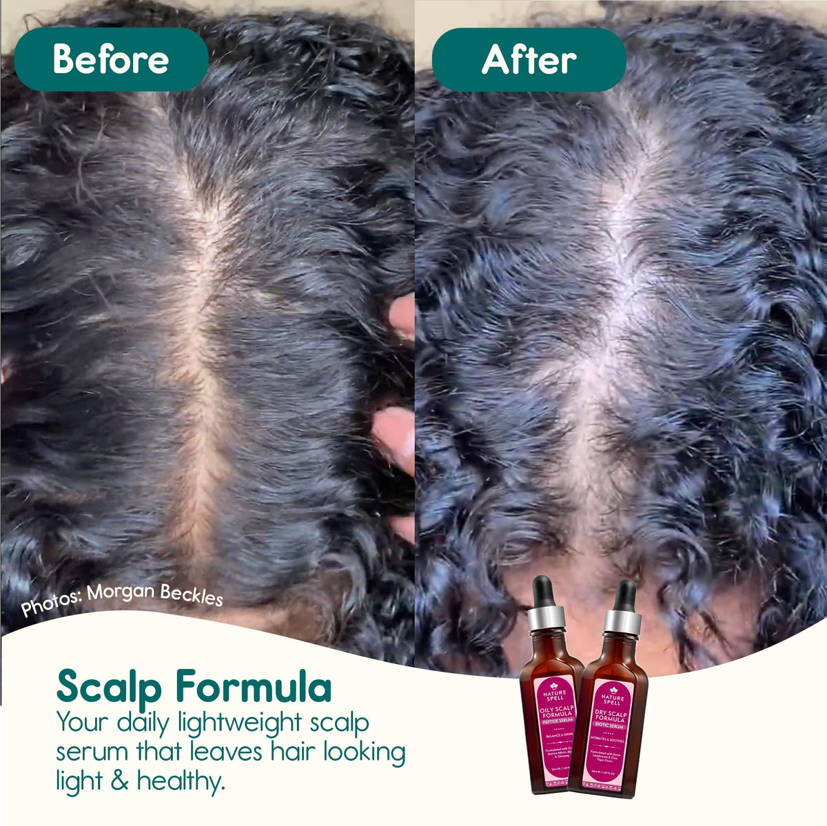 Nature Spell Oily Scalp Serum, Balancing and Clarifying, Lightweight Formula for Scalp and Roots, with Witch Hazel, Ginseng & Zinc, Vegan, 50ml